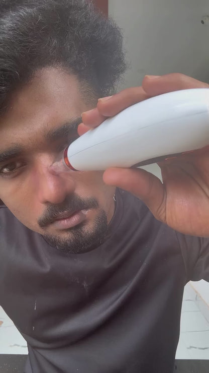 "GlowSkin™ Portable Blackhead Remover"